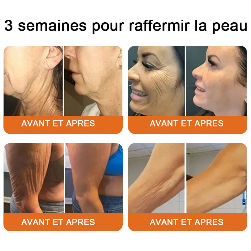 "Fabriqué et expédié de France|✅ Boutique officielle✨Purelora® venin d'abeille Crème réparatrice au 🔥 DERNIER JOUR - 80 % DE RÉDUCTION 💎"