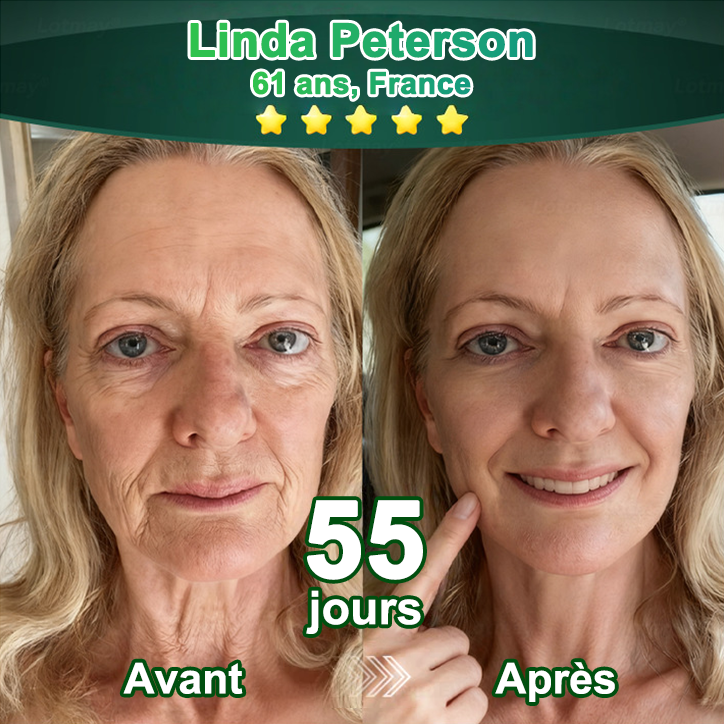 Nouveauté 🔥💖Boutique officielle uniquement💖 | 𝗣𝘂𝗿𝗲𝗹𝗼𝗿𝗮® 𝗦𝘁𝗲𝗺 𝗖𝗲𝗹𝗹 –𝗔𝗰𝘁𝗶𝘃𝗮𝘁𝗲𝗱 𝗖𝗼𝗹𝗹𝗮𝗴𝗲𝗻 𝗣𝗲𝗽𝘁𝗶𝗱𝗲 𝗱𝗿𝗼𝗽𝘀👩‍⚕️(⭐ Raffermit visiblement la peau relâchée et lisse les rides — tout cela de l'intérieur)🌵