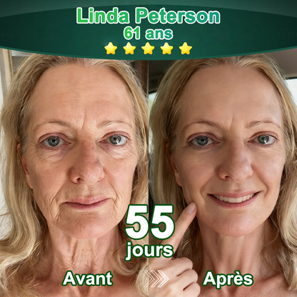 📢Nouveauté 🔥💖Boutique officielle uniquement💖 | 𝗣𝘂𝗿𝗲𝗹𝗼𝗿𝗮® 𝗦𝘁𝗲𝗺 𝗖𝗲𝗹𝗹 –𝗔𝗰𝘁𝗶𝘃𝗮𝘁𝗲𝗱 𝗖𝗼𝗹𝗹𝗮𝗴𝗲𝗻 𝗣𝗲𝗽𝘁𝗶𝗱𝗲 𝗱𝗿𝗼𝗽𝘀👩‍⚕️(⭐ Raffermit visiblement la peau relâchée et lisse les rides — tout cela de l'intérieur)🌵