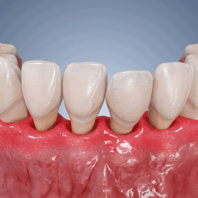 💎🦷𝑷𝒖𝒓𝒆𝒍𝒐𝒓𝒂® 𝑮𝒖𝒎𝑹𝒆𝒗𝒊𝒗𝒆 𝑮𝒆𝒍 𝒅𝒆 𝑹é𝒑𝒂𝒓𝒂𝒕𝒊𝒐𝒏 𝑷𝒂𝒓𝒐𝒅𝒐𝒏𝒕𝒂𝒍𝒆🦷
