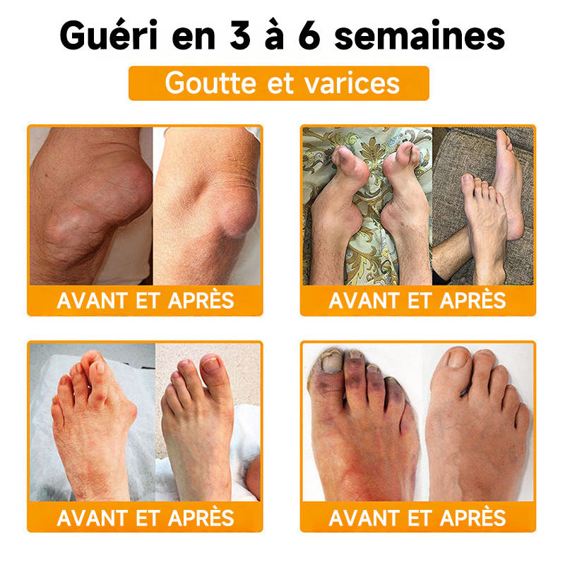 Boutique officielle en France 🇫🇷 Purelora® Bee Venom Pain Relief Joint Repair Cream 🐝🐝 (Soulagement rapide de la douleur · Réduction de l’inflammation · Soutien des articulations et des os)