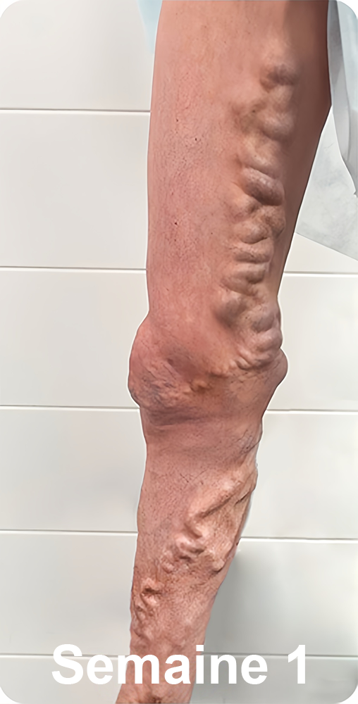 📢[💎Boutique officielle de la marque💎] LuckySong® Chaussettes réparatrices sculptantes en fibre ionique de soie glacée 2026