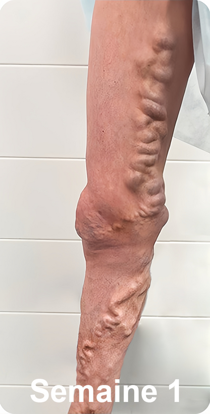 📢[💎Boutique officielle de la marque💎] LuckySong® Chaussettes réparatrices sculptantes en fibre ionique de soie glacée 2026