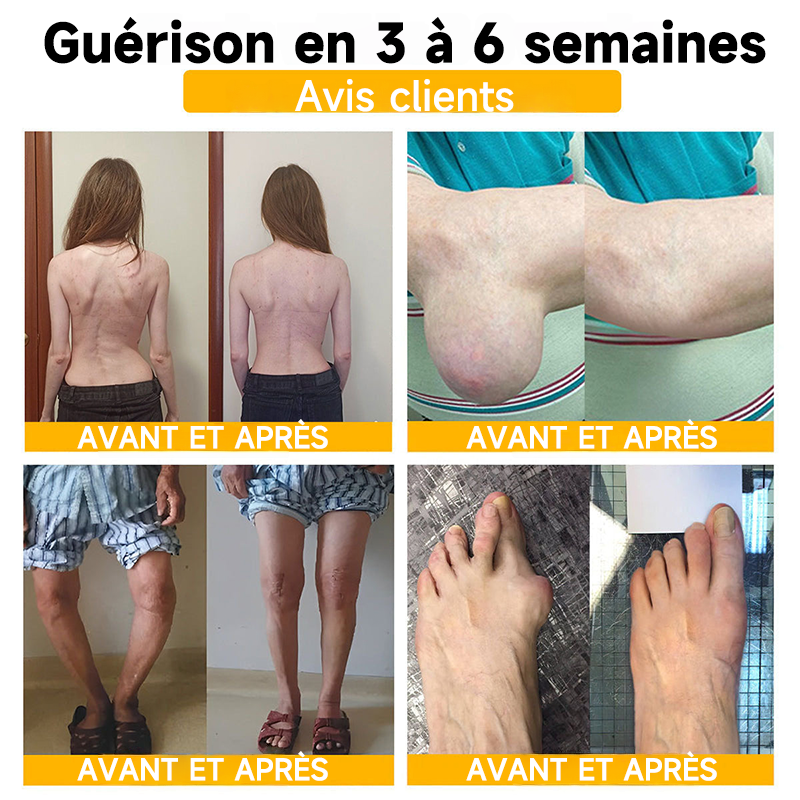 Boutique officielle en France 🇫🇷 Purelora® Bee Venom Pain Relief Joint Repair Cream 🐝🐝 (Soulagement rapide de la douleur · Réduction de l’inflammation · Soutien des articulations et des os)