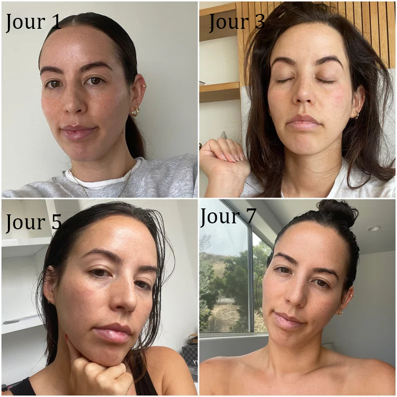 📢Nouveauté 🔥💖Boutique officielle uniquement💖 | 𝗣𝘂𝗿𝗲𝗹𝗼𝗿𝗮® 𝗦𝘁𝗲𝗺 𝗖𝗲𝗹𝗹 –𝗔𝗰𝘁𝗶𝘃𝗮𝘁𝗲𝗱 𝗖𝗼𝗹𝗹𝗮𝗴𝗲𝗻 𝗣𝗲𝗽𝘁𝗶𝗱𝗲 𝗱𝗿𝗼𝗽𝘀👩‍⚕️(⭐ Raffermit visiblement la peau relâchée et lisse les rides — tout cela de l'intérieur)🌵
