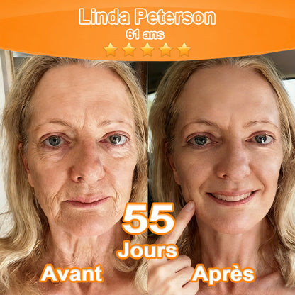 Crème Essence Revitalisante Purelora® à l’Extrait de Cellules Souches, EGF et Peptides de Cuivre (active en profondeur le processus naturel de régénération de la peau, pour une peau visiblement plus ferme et plus lisse)