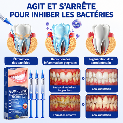💎🦷𝑷𝒖𝒓𝒆𝒍𝒐𝒓𝒂® 𝑮𝒖𝒎𝑹𝒆𝒗𝒊𝒗𝒆 𝑮𝒆𝒍 𝒅𝒆 𝑹é𝒑𝒂𝒓𝒂𝒕𝒊𝒐𝒏 𝑷𝒂𝒓𝒐𝒅𝒐𝒏𝒕𝒂𝒍𝒆🦷