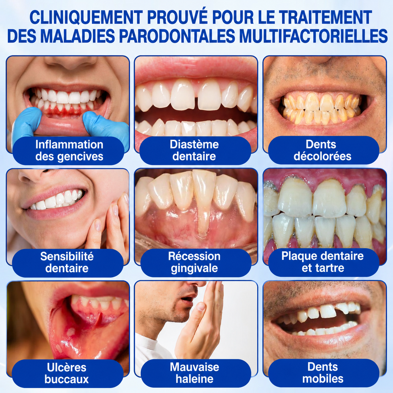 💎🦷𝑷𝒖𝒓𝒆𝒍𝒐𝒓𝒂® 𝑮𝒖𝒎𝑹𝒆𝒗𝒊𝒗𝒆 𝑮𝒆𝒍 𝒅𝒆 𝑹é𝒑𝒂𝒓𝒂𝒕𝒊𝒐𝒏 𝑷𝒂𝒓𝒐𝒅𝒐𝒏𝒕𝒂𝒍𝒆🦷