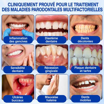 💎🦷𝑷𝒖𝒓𝒆𝒍𝒐𝒓𝒂® 𝑮𝒖𝒎𝑹𝒆𝒗𝒊𝒗𝒆 𝑮𝒆𝒍 𝒅𝒆 𝑹é𝒑𝒂𝒓𝒂𝒕𝒊𝒐𝒏 𝑷𝒂𝒓𝒐𝒅𝒐𝒏𝒕𝒂𝒍𝒆🦷