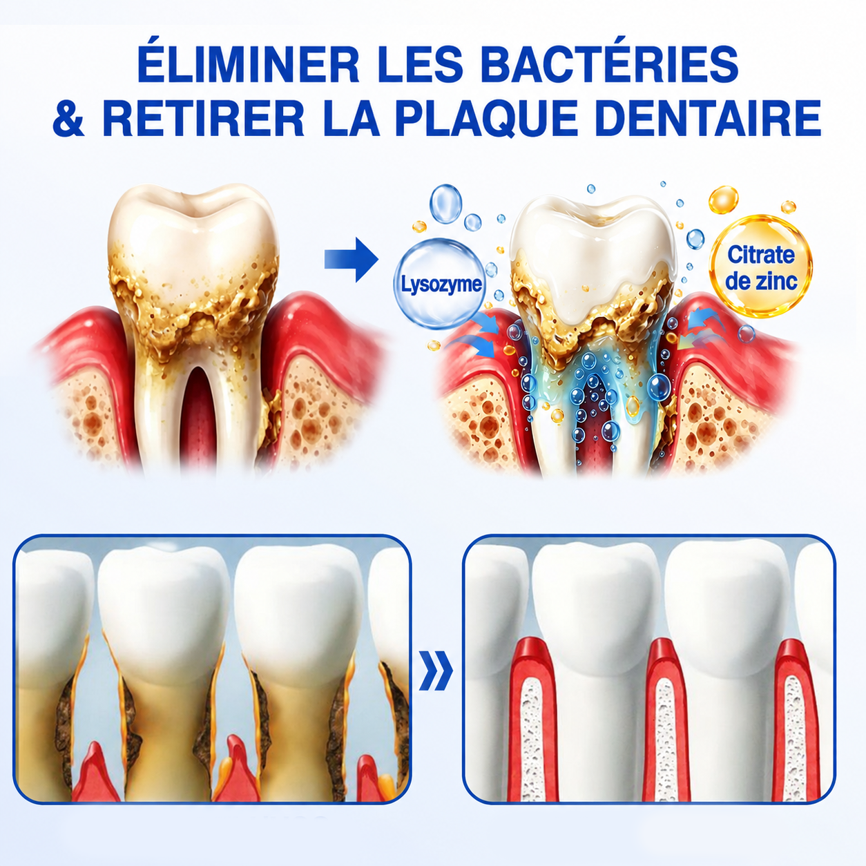 💎🦷𝑷𝒖𝒓𝒆𝒍𝒐𝒓𝒂® 𝑮𝒖𝒎𝑹𝒆𝒗𝒊𝒗𝒆 𝑮𝒆𝒍 𝒅𝒆 𝑹é𝒑𝒂𝒓𝒂𝒕𝒊𝒐𝒏 𝑷𝒂𝒓𝒐𝒅𝒐𝒏𝒕𝒂𝒍𝒆🦷